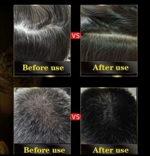 3 In 1 Black Hair Dye Shampoo (BUY 1 GET 1 FREE)